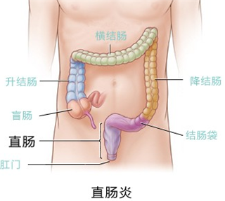 阜阳兆岐肛肠医院