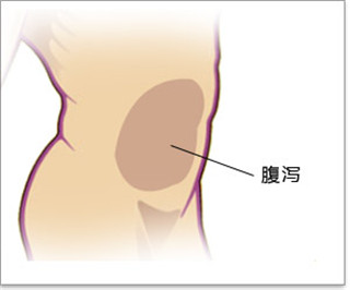 阜阳肛肠医院